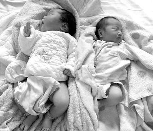 10.2斤宝宝（左）和一般新生儿对比