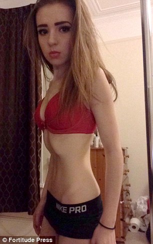 英女孩患厌食症仅25公斤 靠钢管舞康复