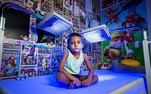 英4岁男童患怪病 每天需蓝光照射20小时