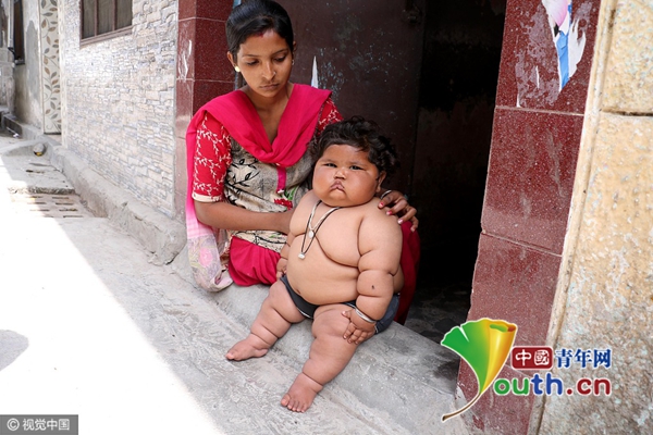 印度8个月婴儿体重34斤 演绎真人版“米其林小胖人”