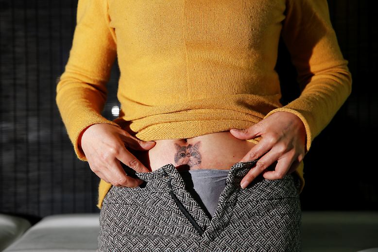 中国纹身师用这些图案美化剖宫产疤痕