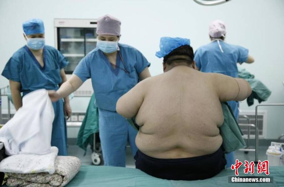 山西344斤重男子缩胃减重 术后想带儿旅行